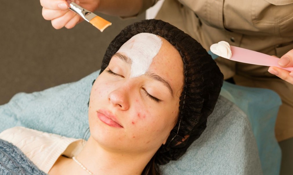 Mengapa-Perawatan-Jerawat-Itu-Penting