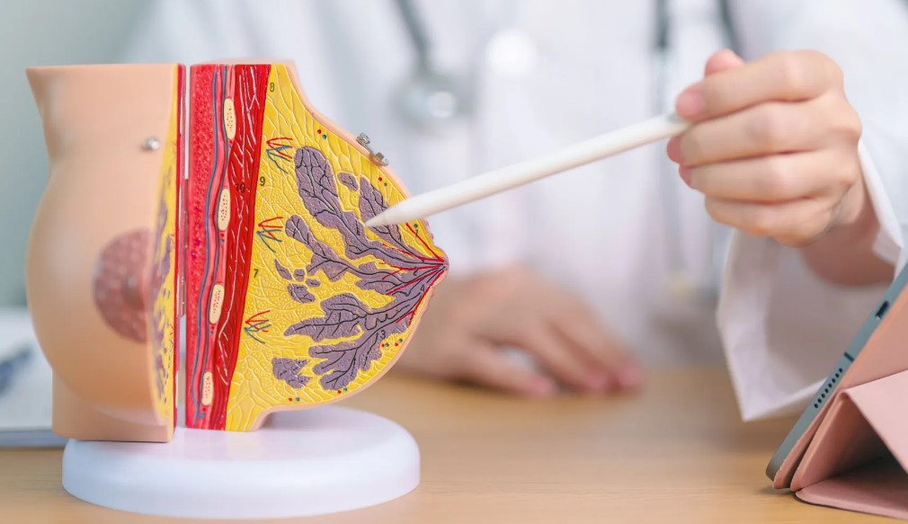 Mengapa-Perawatan-Kanker-Payudara-Sangat-Dibutuhkan