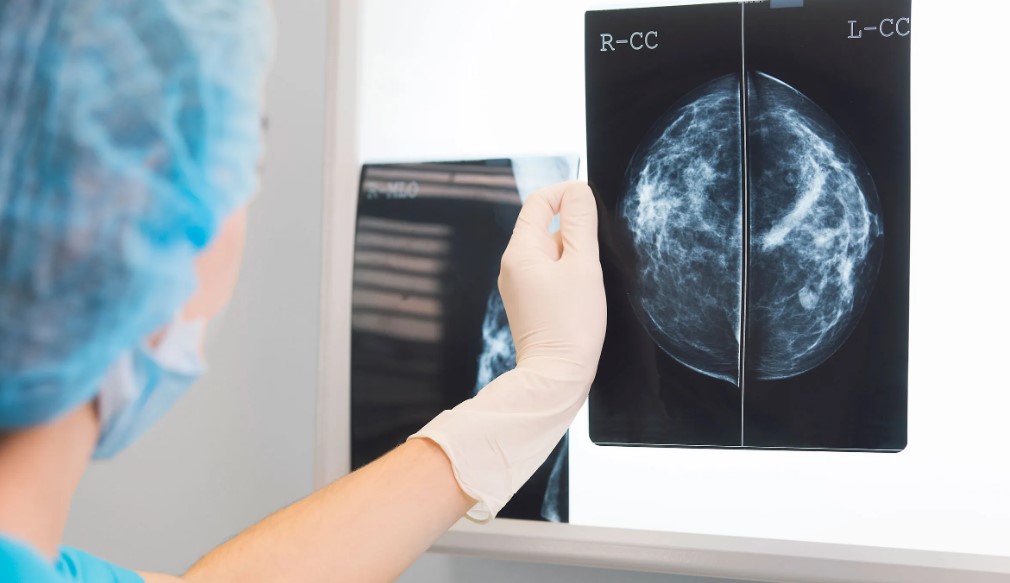 Teknologi-Modern-dalam-Perawatan-Kanker-Payudara